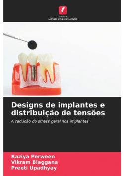 Designs de implantes e distribuição de tensões