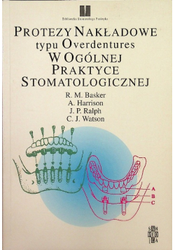 Protezy nakładowe typu Overdentures w ogólnej praktyce stomatologicznej