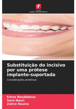 Substituição do incisivo por uma prótese implanto-suportada