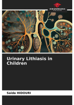 Urinary Lithiasis in Children