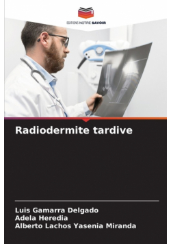 Radiodermite tardive