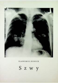 Szwy