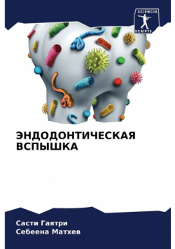ЭНДОДОНТИЧЕСКАЯ ВСПЫШКА