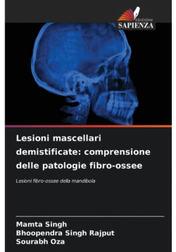 Lesioni mascellari demistificate