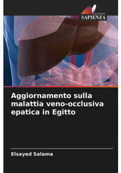Aggiornamento sulla malattia veno-occlusiva epatica in Egitto
