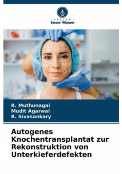 Autogenes Knochentransplantat zur Rekonstruktion von Unterkieferdefekten