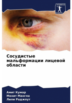 Сосудистые мальформации лицевой области