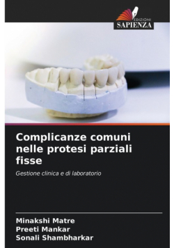 Complicanze comuni nelle protesi parziali fisse