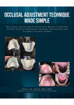 Occlusal Adjustment Technique Made Simple