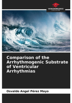 Comparison of the Arrhythmogenic Substrate of Ventricular Arrhythmias